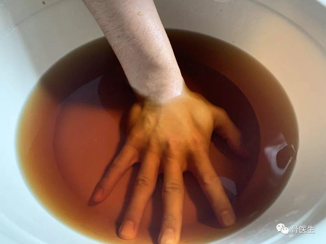 街舞 | 每个炸场动作的背后，你的手腕都在默默承受伤痛…