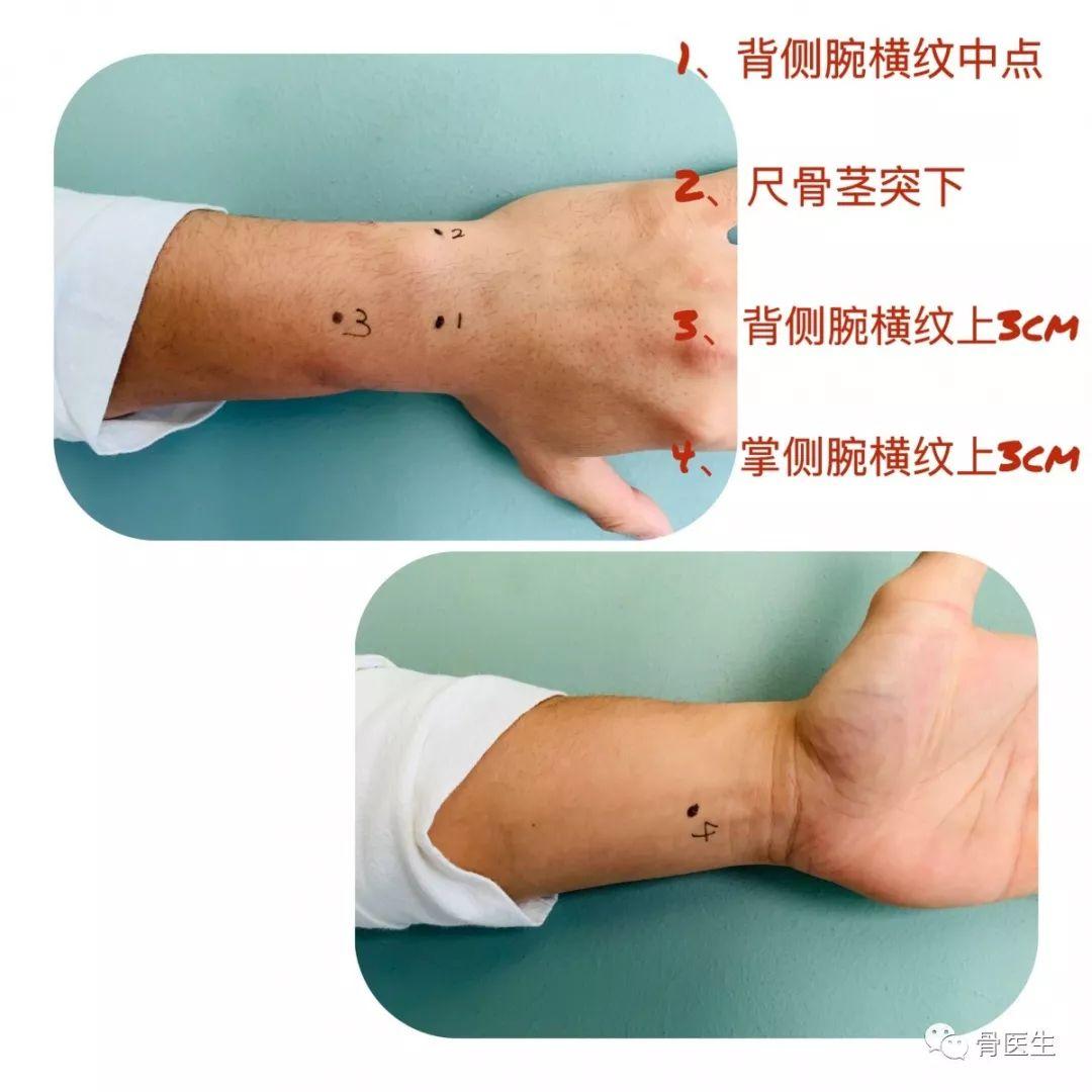 街舞 | 每个炸场动作的背后，你的手腕都在默默承受伤痛…