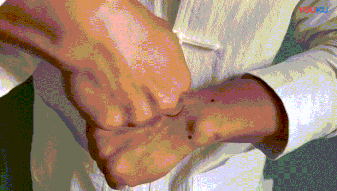 街舞 | 每个炸场动作的背后，你的手腕都在默默承受伤痛…