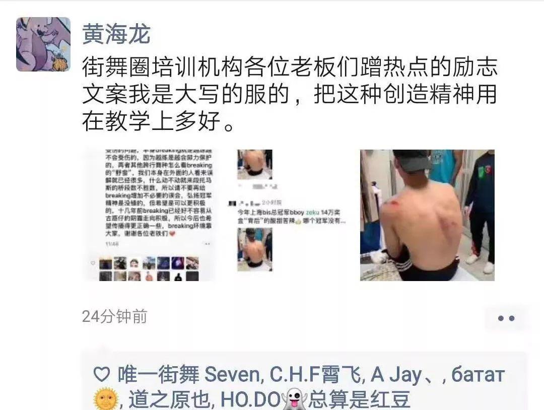 Bboy Zeku 拿下2019BIS WORLD WARS冠军,“Bboy练舞受伤”系误传 | 第10张 | 嘻哈中国 Bboy Zeku 拿下2019BIS WORLD WARS冠军,“Bboy练舞受伤”系误传 | 第10张